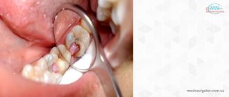 Болезни зубов и полости рта