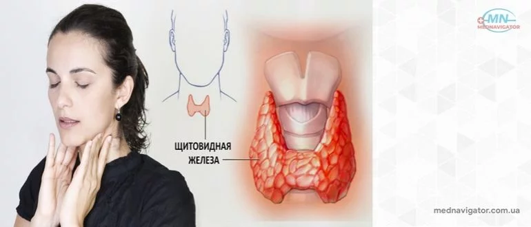 Заболевания щитовидной железы.