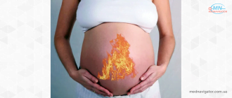 Изжога при беременности: причины появления и способы лечения