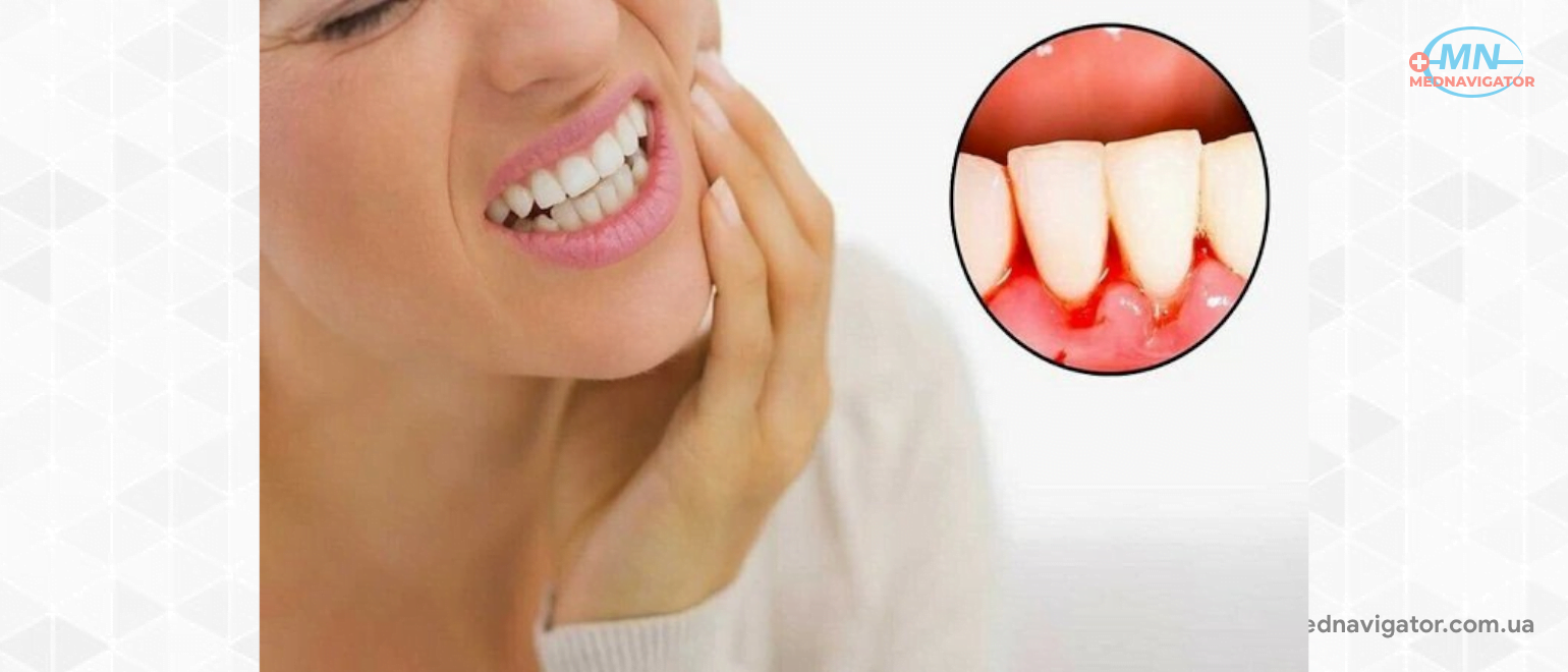 Чистят ли зубы солью. Чистят ли зубы солью. Чистят ли зубы солью. Чистить зубы солью. Отбеливание зубов содой и зубной пастой.