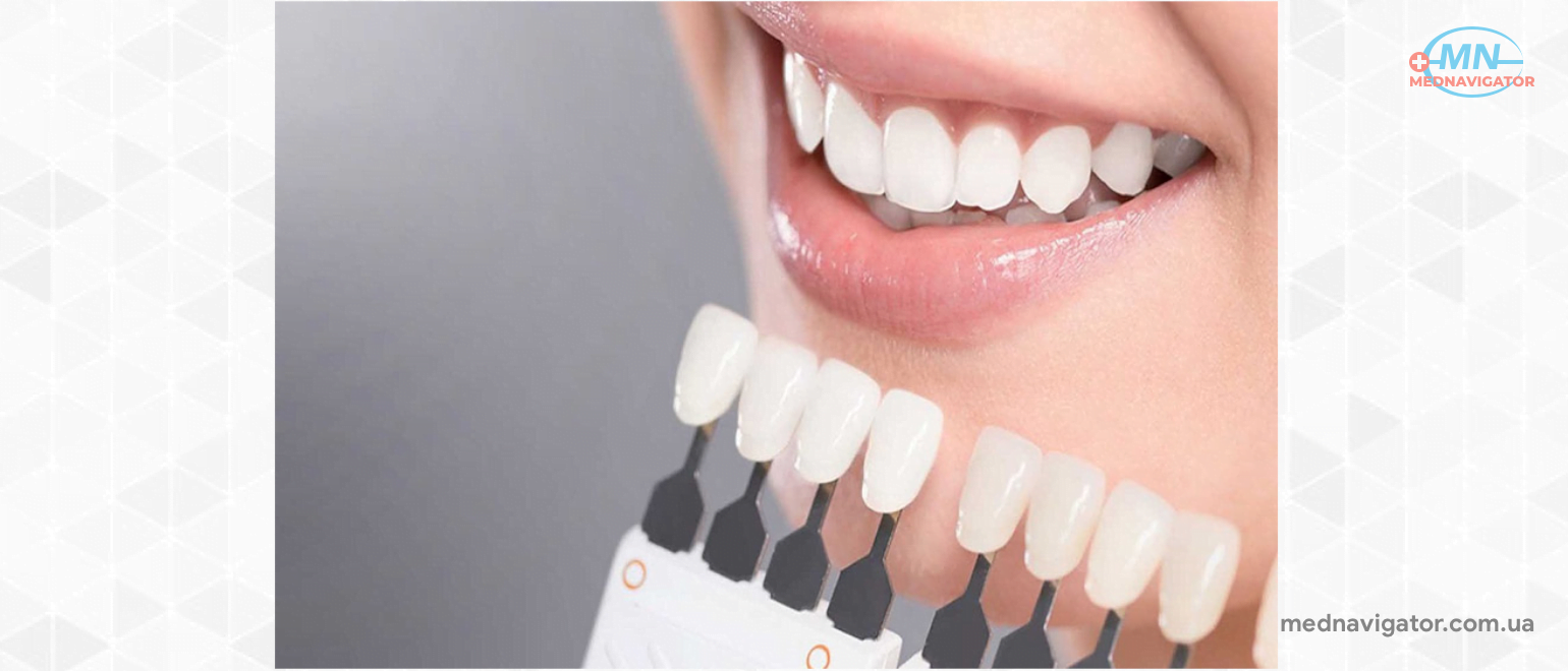 4 самых больших недостатка отбеливания зубов