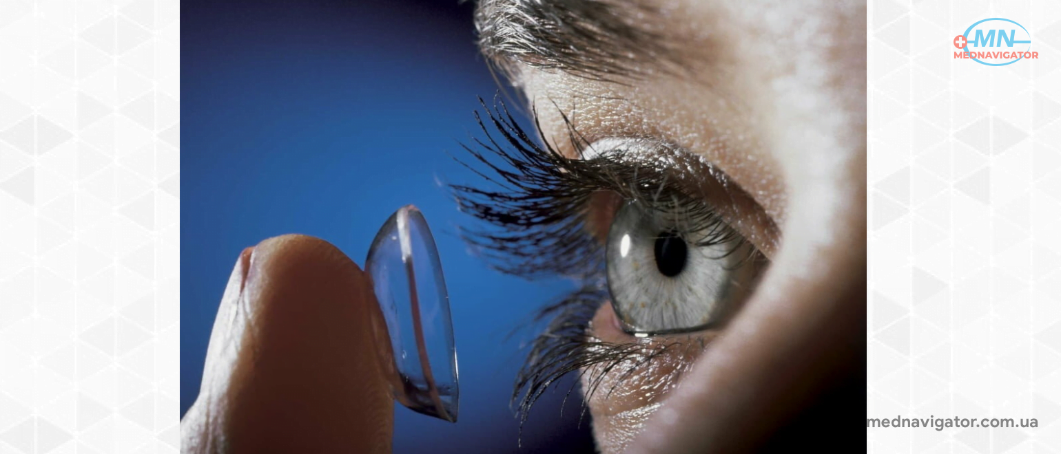 Мягкие контактные линзы – как за ними ухаживать?